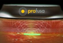 Profusa Lumee Oxygen digital health device interacting with sensor under person's skin.