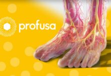 Illustration of human feet showing blood vessels with the Profusa logo on a yellow background.