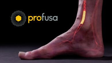 Medical illustration of a foot with glowing internal sensor and blood vessels highlighted, next to the Profusa company logo on a black background.